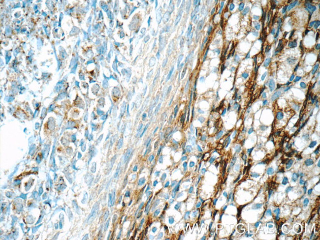 HSD17B11 Antibody in Immunohistochemistry (Paraffin) (IHC (P))