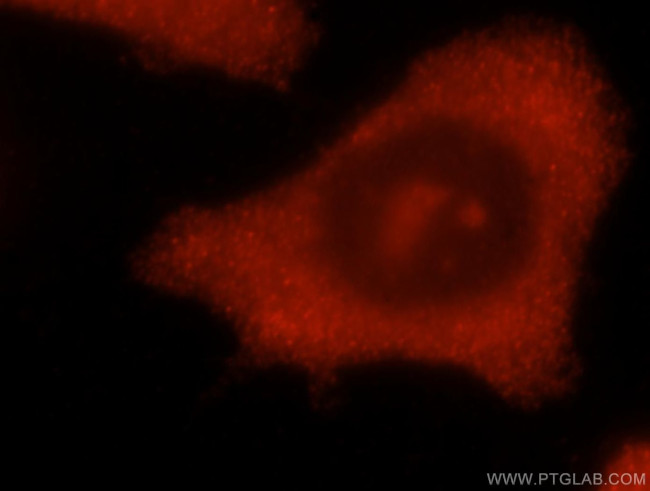 CHAC2 Antibody in Immunocytochemistry (ICC/IF)