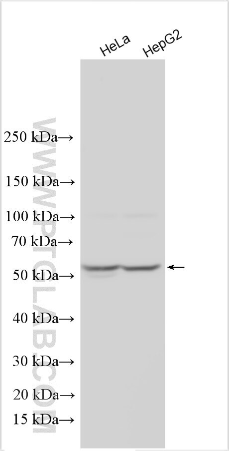 SMPDL3A Antibody in Western Blot (WB)