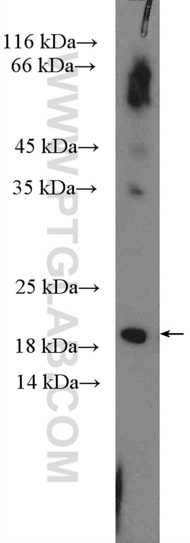 RAB30 Antibody in Western Blot (WB)