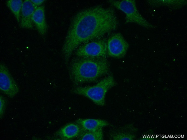 BTD Antibody in Immunocytochemistry (ICC/IF)
