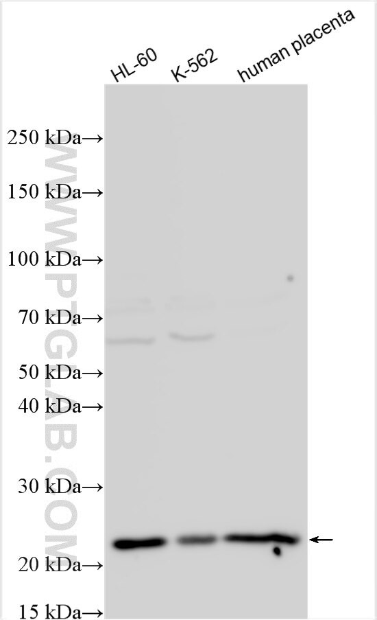 PKD1L2 Antibody in Western Blot (WB)