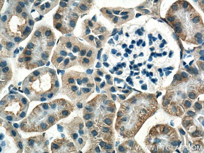 GPR146 Antibody in Immunohistochemistry (Paraffin) (IHC (P))