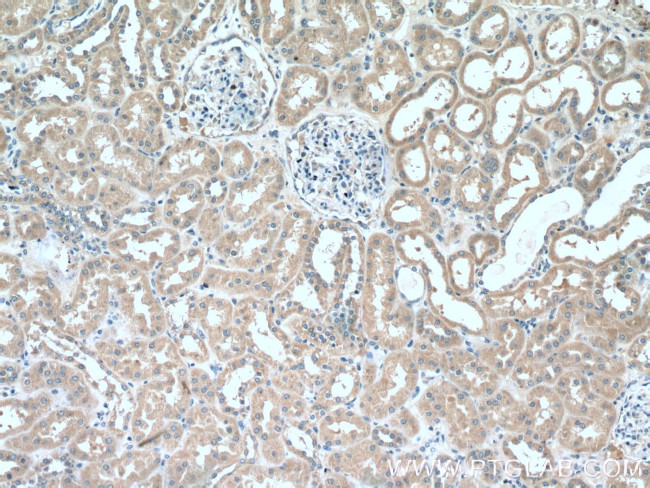 ABP1 Antibody in Immunohistochemistry (Paraffin) (IHC (P))