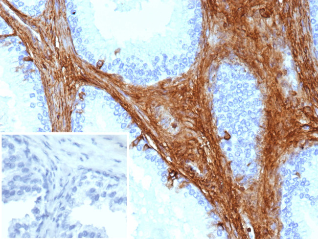 Decorin Antibody in Immunohistochemistry (Paraffin) (IHC (P))