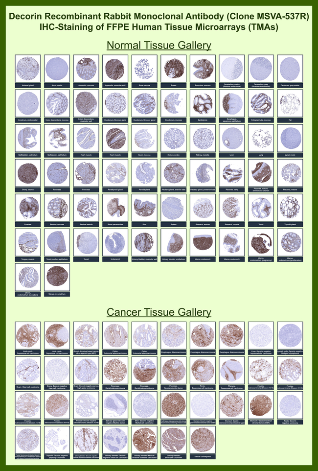 Decorin Antibody in Immunohistochemistry (Paraffin) (IHC (P))