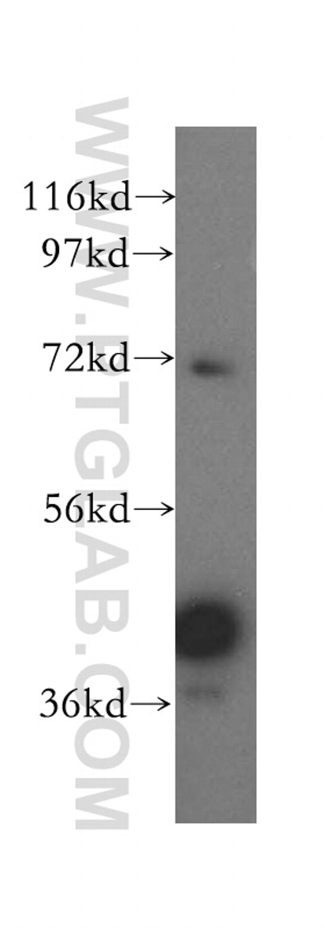 GFOD2 Antibody in Western Blot (WB)