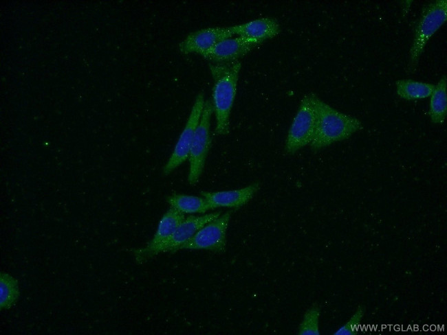 FARSB Antibody in Immunocytochemistry (ICC/IF)