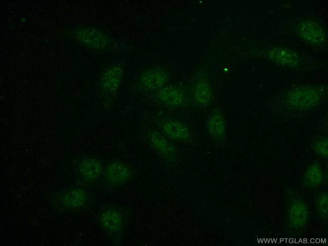 GINS3 Antibody in Immunocytochemistry (ICC/IF)