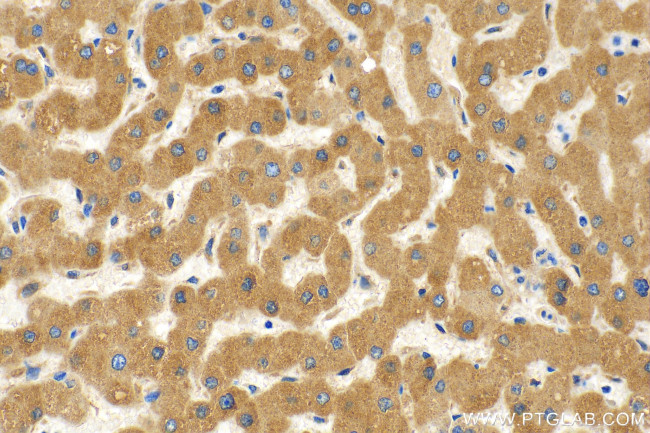 CYP2C9 Antibody in Immunohistochemistry (Paraffin) (IHC (P))