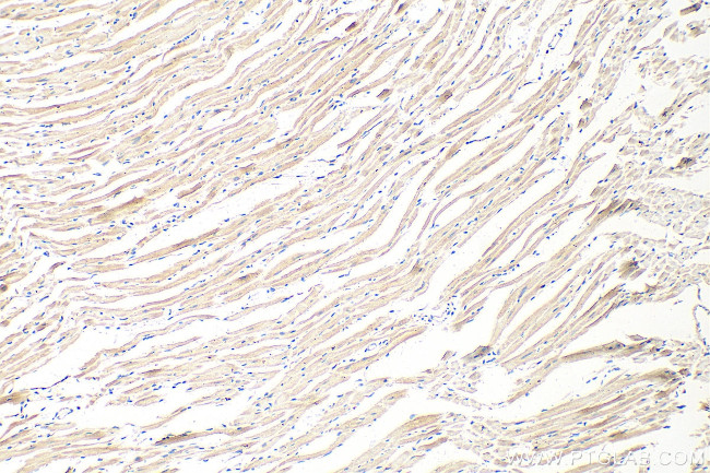 TMEM43 Antibody in Immunohistochemistry (Paraffin) (IHC (P))