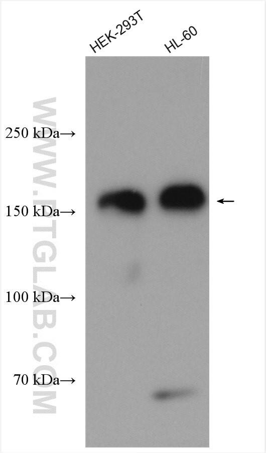 WAPL/WAPAL Antibody in Western Blot (WB)