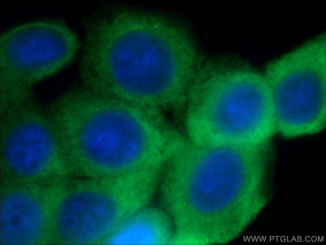 GTPBP9 Antibody in Immunocytochemistry (ICC/IF)