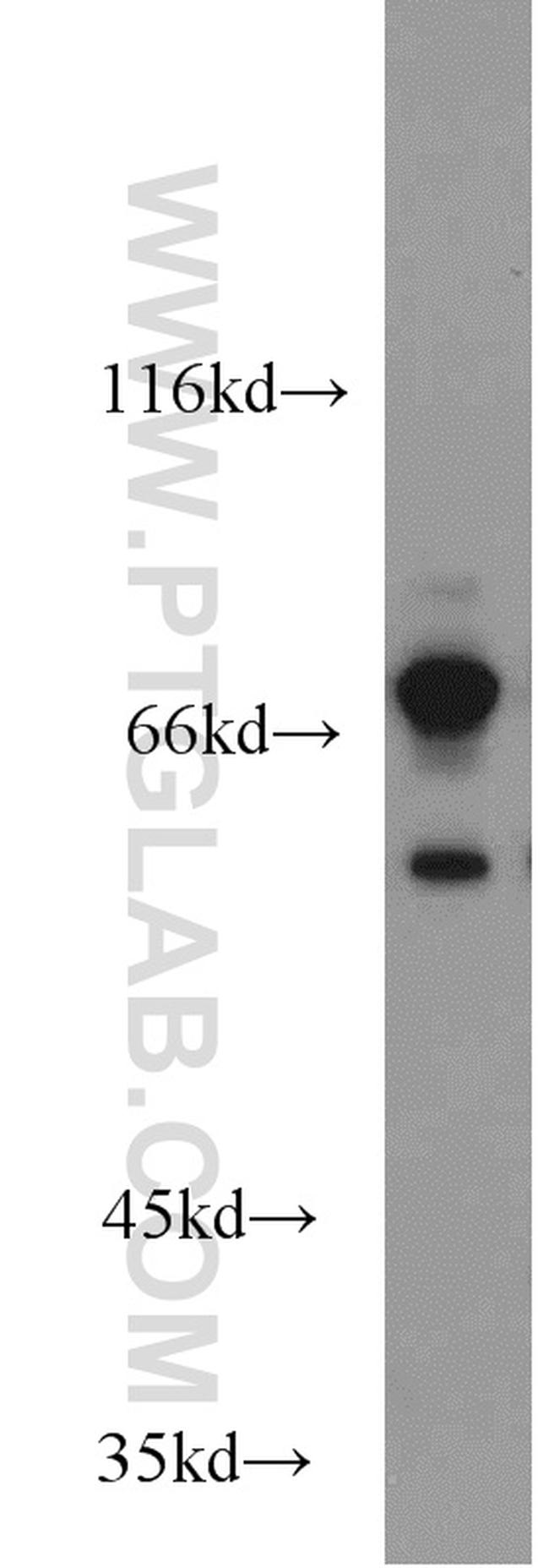 GTPBP1 Antibody in Western Blot (WB)