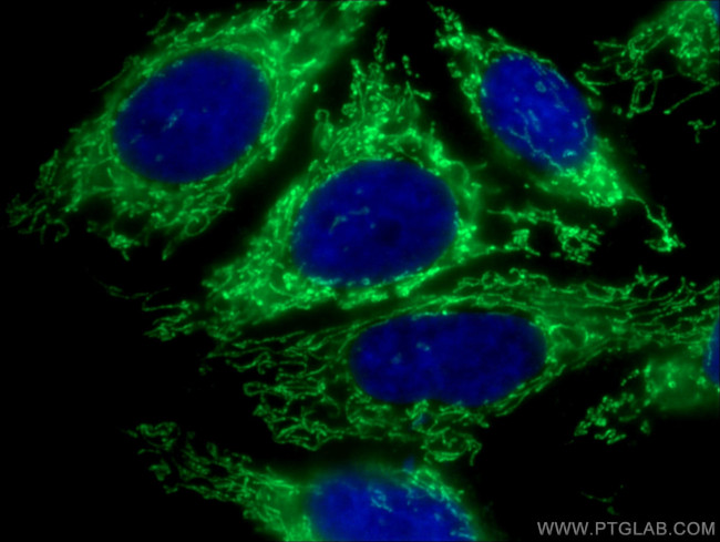 MRPS28 Antibody in Immunocytochemistry (ICC/IF)