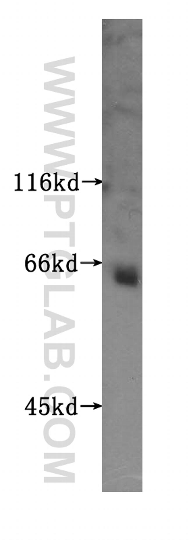 PODXL2 Antibody in Western Blot (WB)