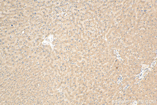 CSNK1G1 Antibody in Immunohistochemistry (Paraffin) (IHC (P))
