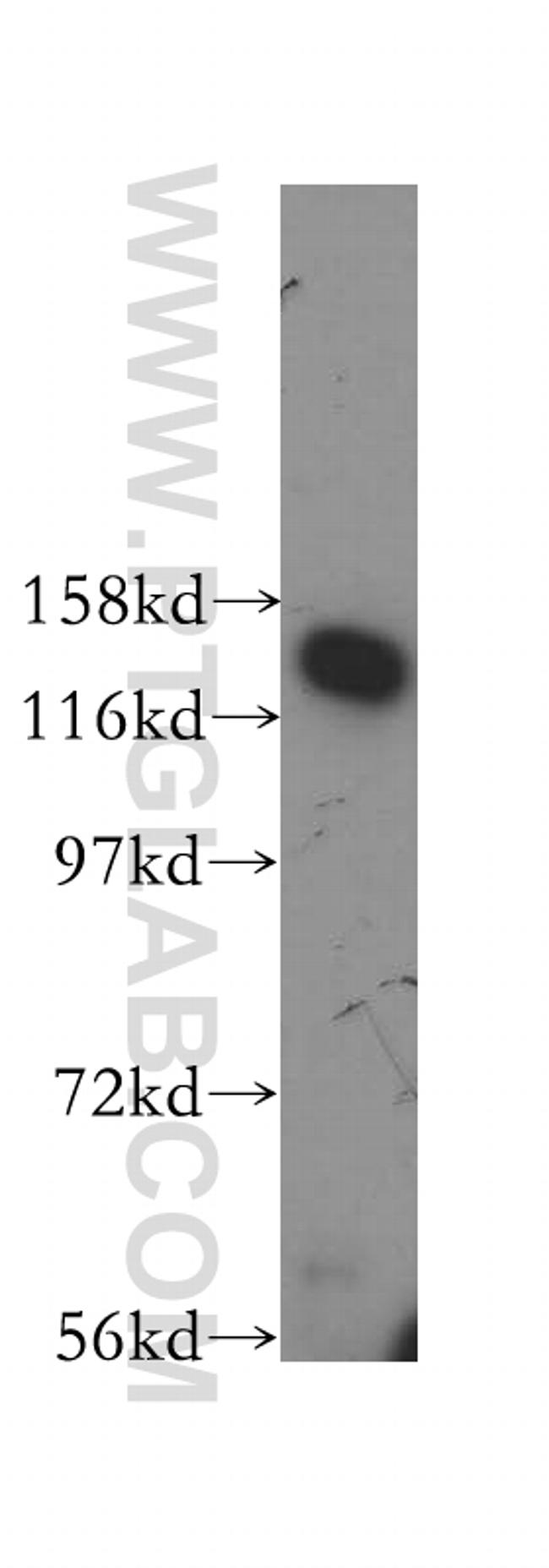 NFX1 Antibody in Western Blot (WB)
