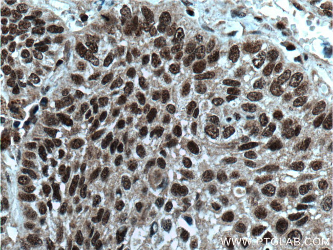 BANP Antibody in Immunohistochemistry (Paraffin) (IHC (P))
