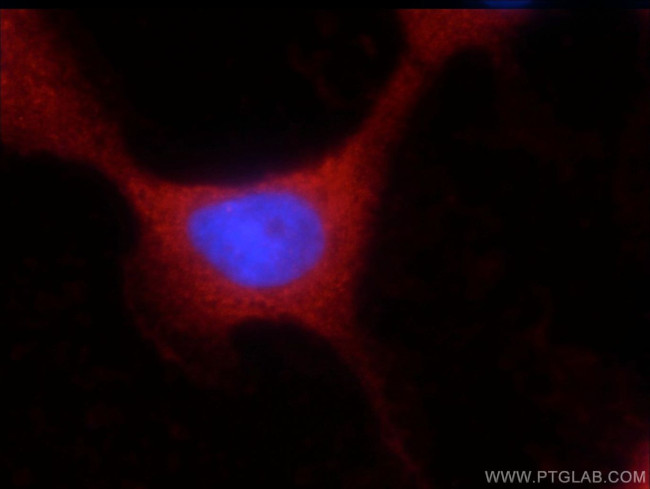 UBQLNL Antibody in Immunocytochemistry (ICC/IF)