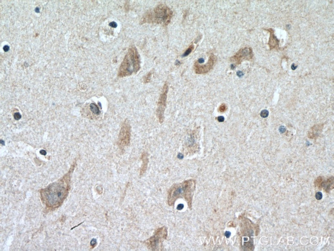 CERCAM Antibody in Immunohistochemistry (Paraffin) (IHC (P))