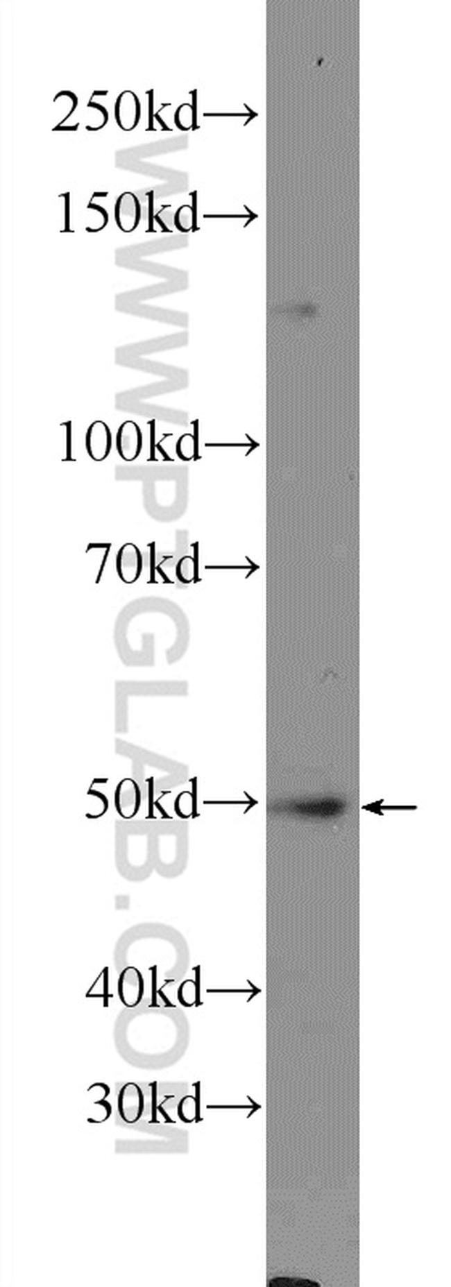 NLE1 Antibody in Western Blot (WB)
