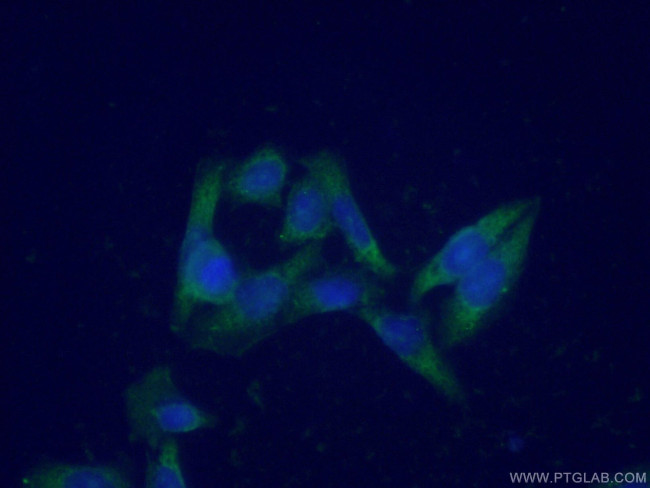 ENO3 Antibody in Immunocytochemistry (ICC/IF)