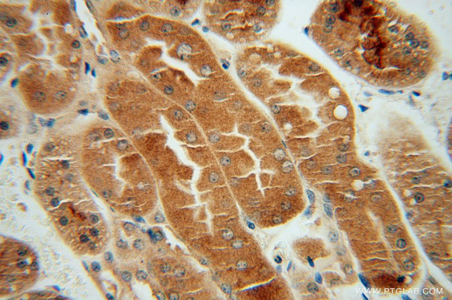 CHMP7 Antibody in Immunohistochemistry (Paraffin) (IHC (P))