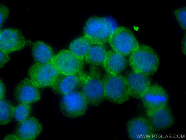 RNASE6 Antibody in Immunocytochemistry (ICC/IF)