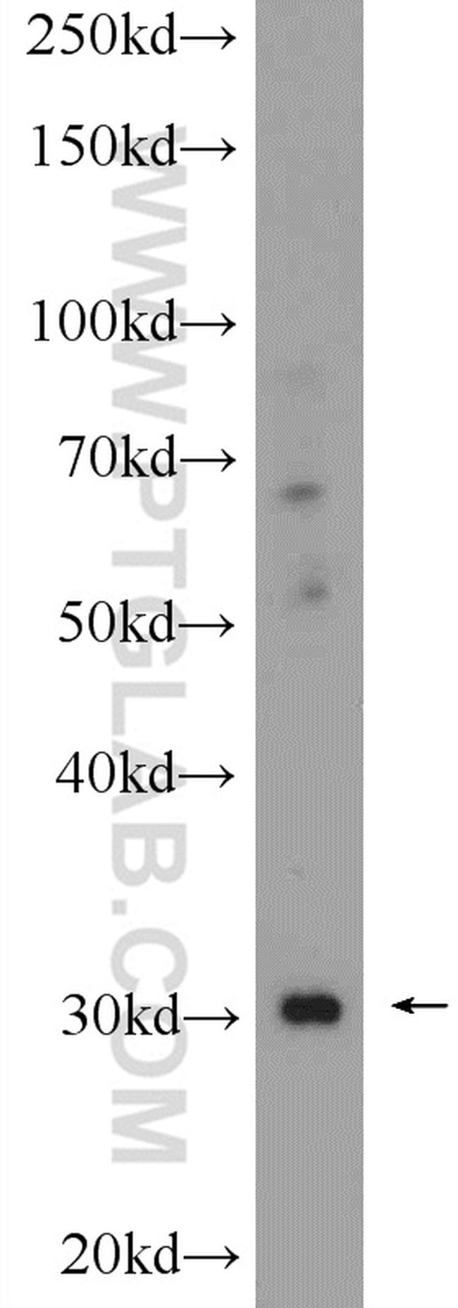 CHST8 Antibody in Western Blot (WB)