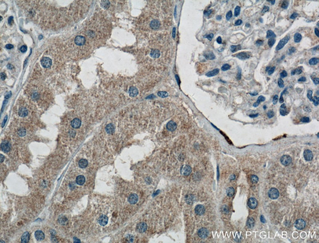 MRPS5 Antibody in Immunohistochemistry (Paraffin) (IHC (P))