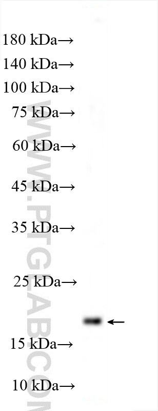 RBM38 Antibody in Western Blot (WB)