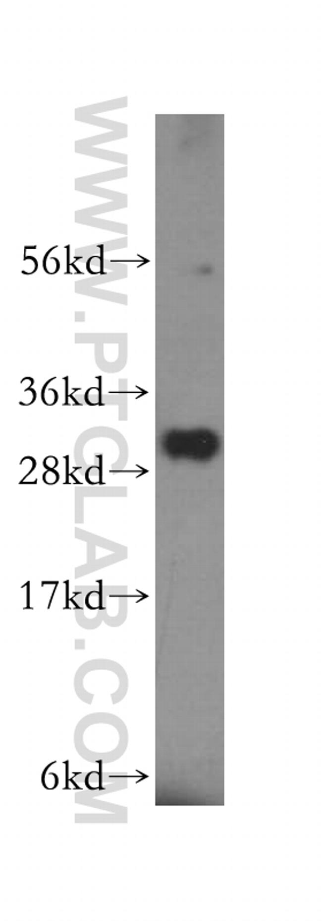 NIT2 Antibody in Western Blot (WB)