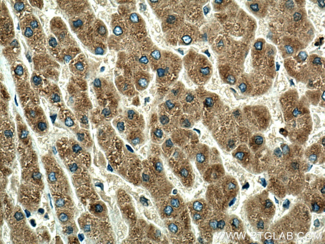 ORM1 Antibody in Immunohistochemistry (Paraffin) (IHC (P))