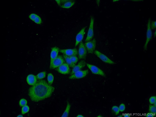 ERK1/2 Antibody in Immunocytochemistry (ICC/IF)