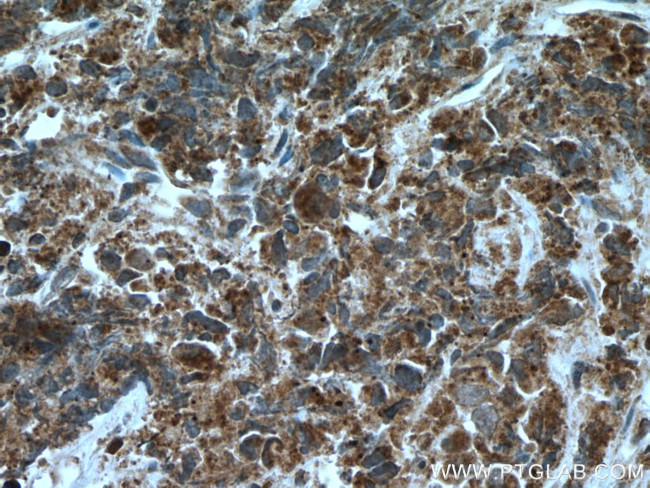 AGXT2L2 Antibody in Immunohistochemistry (Paraffin) (IHC (P))