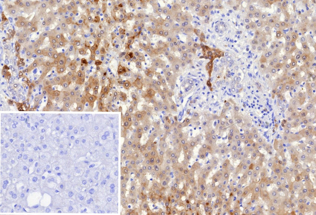 Aldo-keto Reductase Family 1 Member C1/DD1 Antibody in Immunohistochemistry (Paraffin) (IHC (P))