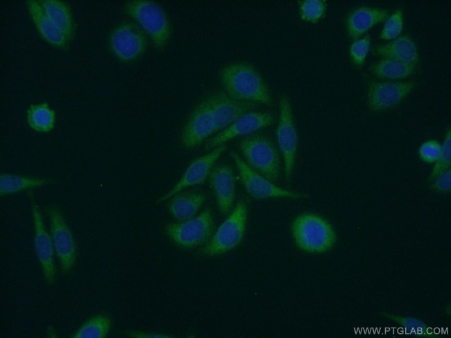 DNAJB5 Antibody in Immunocytochemistry (ICC/IF)