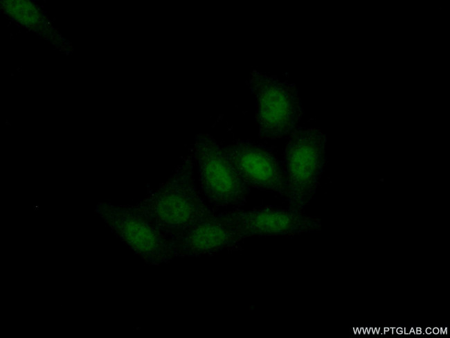 XPA Antibody in Immunocytochemistry (ICC/IF)