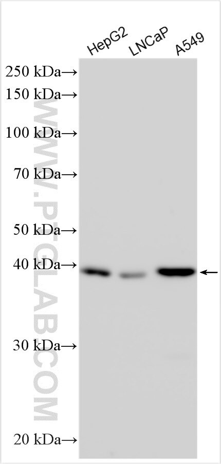 TBC1D20 Antibody in Western Blot (WB)