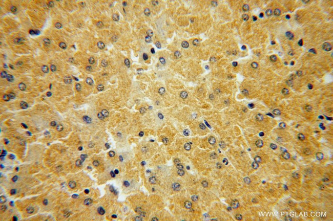HGD Antibody in Immunohistochemistry (Paraffin) (IHC (P))