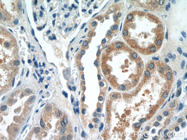 DPEP2 Antibody in Immunohistochemistry (Paraffin) (IHC (P))