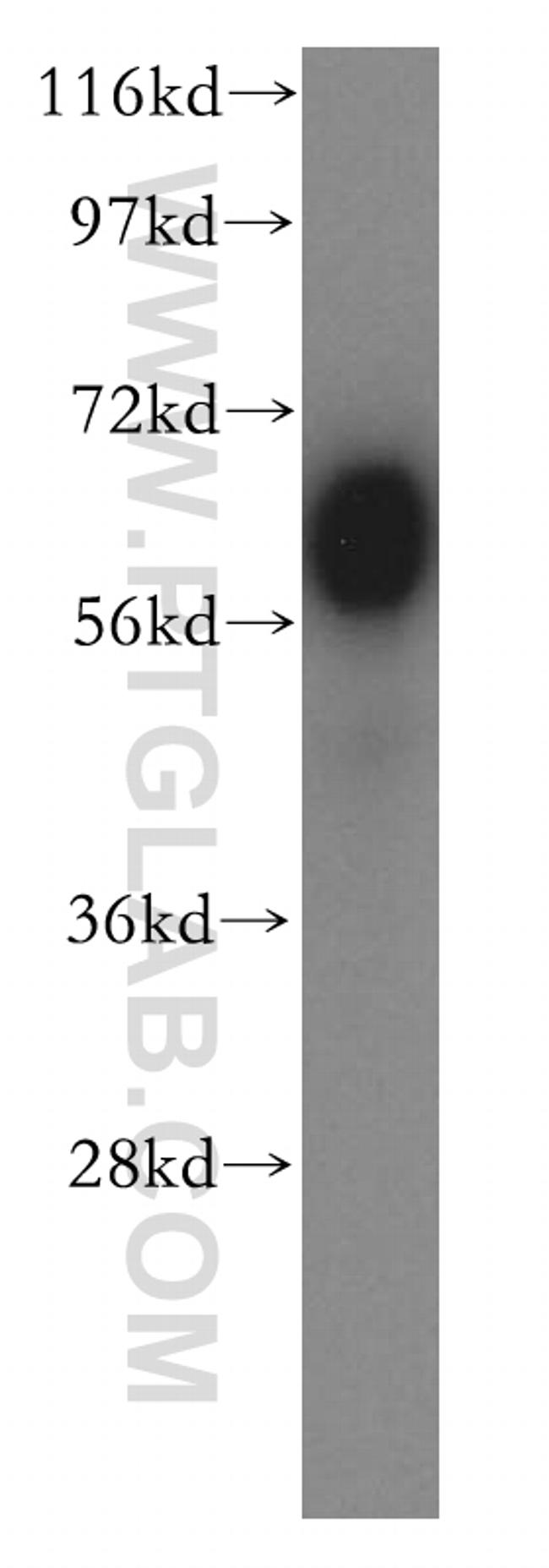 BTN2A2 Antibody in Western Blot (WB)