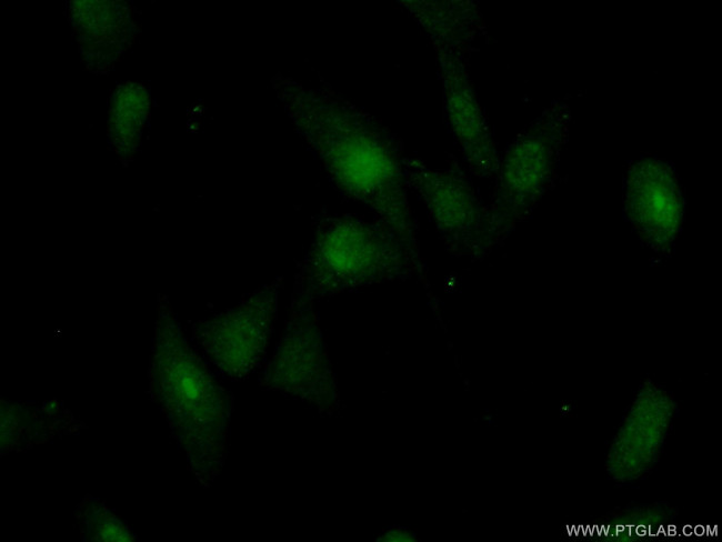 RBM28 Antibody in Immunocytochemistry (ICC/IF)