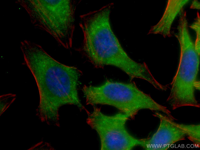 EDC3 Antibody in Immunocytochemistry (ICC/IF)