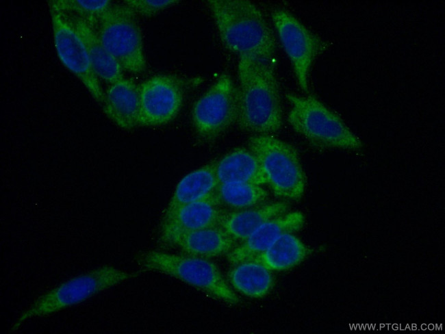 RPL26L1 Antibody in Immunocytochemistry (ICC/IF)