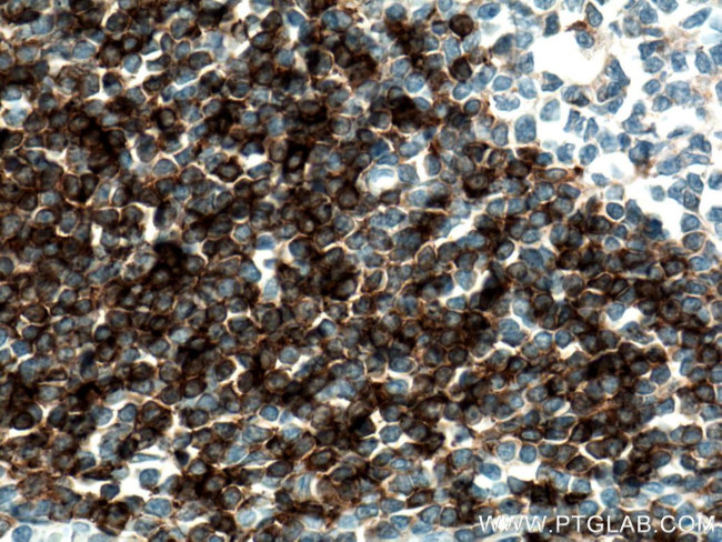 IGHD Antibody in Immunohistochemistry (Paraffin) (IHC (P))