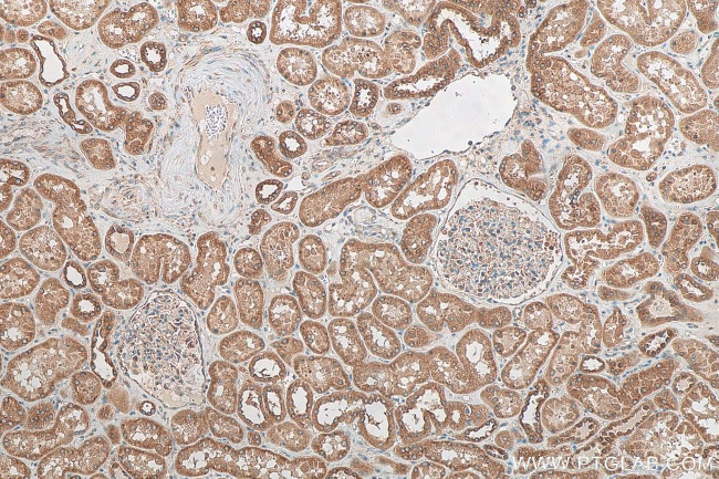 KLC4 Antibody in Immunohistochemistry (Paraffin) (IHC (P))