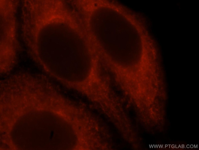 Moesin Antibody in Immunocytochemistry (ICC/IF)