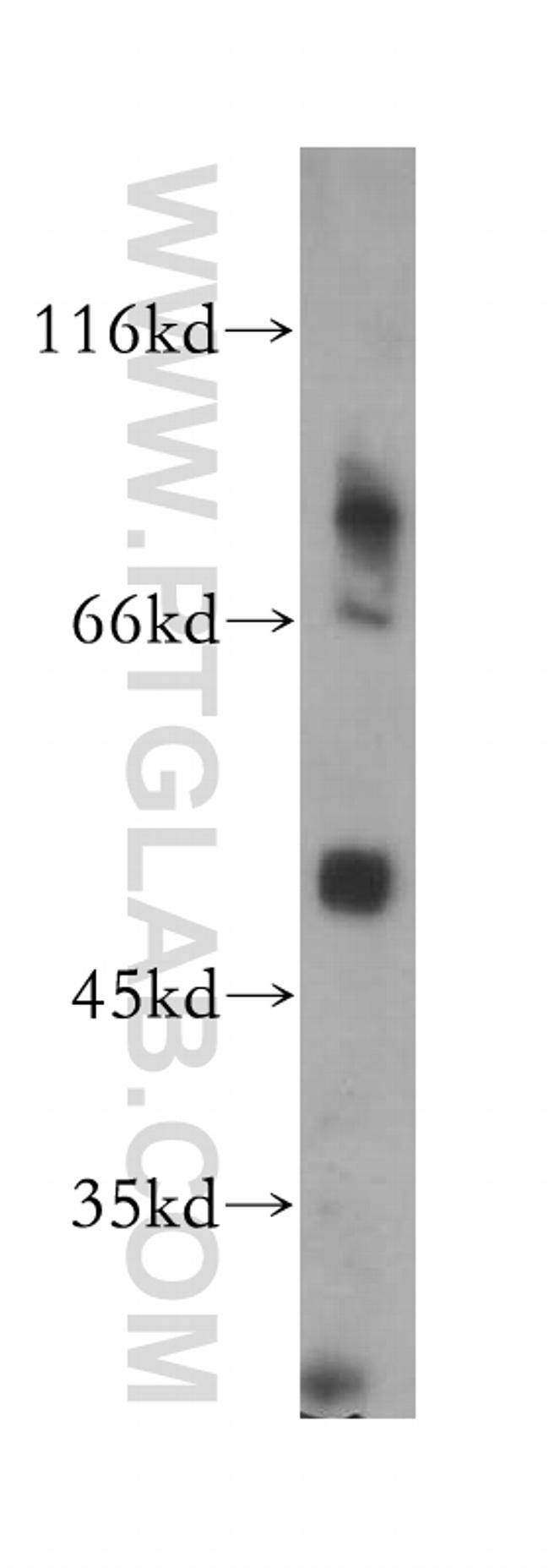 GPR137B Antibody in Western Blot (WB)